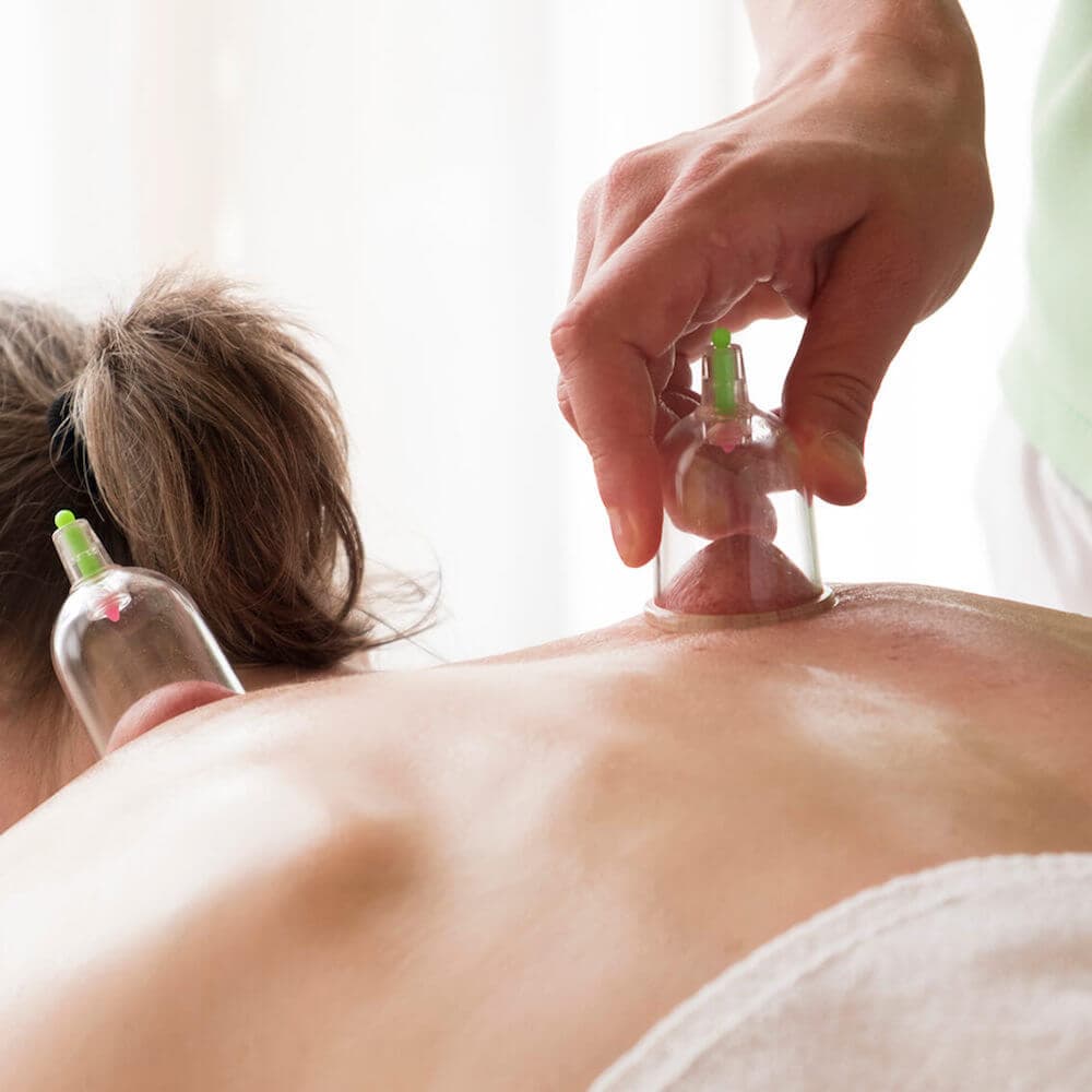 Cupping Massage
